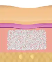 艾麗斯注射一週後