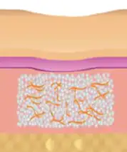 艾麗斯注射4-8週後