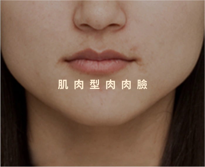 肌肉型肉肉臉