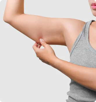 體重輕卻有副乳、蝴蝶袖