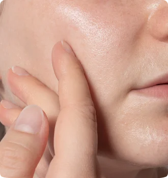 油性肌膚易出油