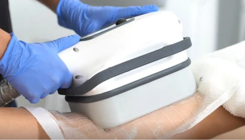 Cooltech Define Procedure Image