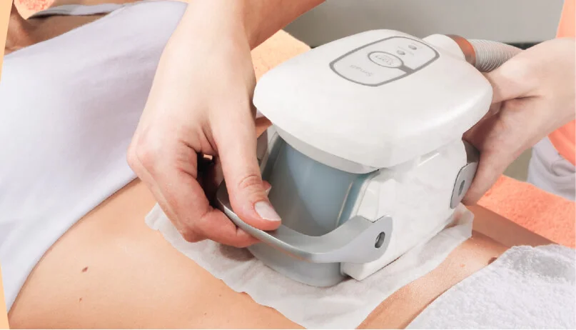 Zlipo Procedure Image