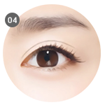 術後呈現自然的雙眼皮