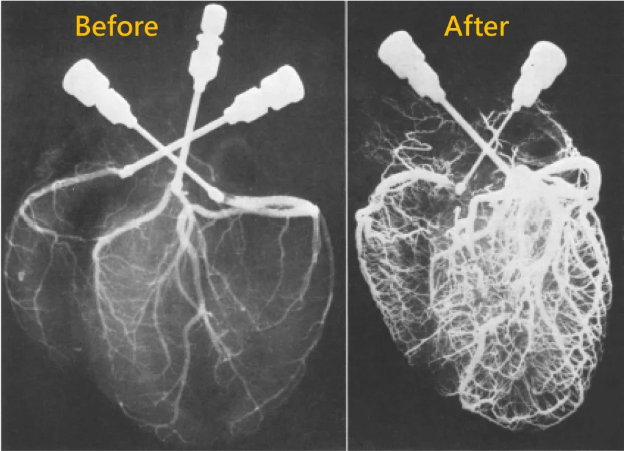 增加全身微血管增生