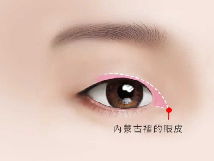 內蒙古摺的眼皮