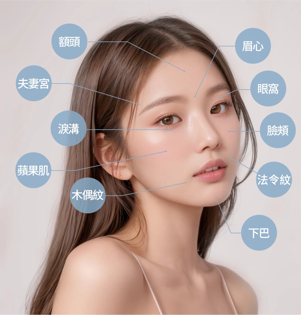 可填補部位-額頭、夫妻宮、淚溝、蘋果肌、木偶紋、眉心、眼窩、臉頰、法令紋、下巴