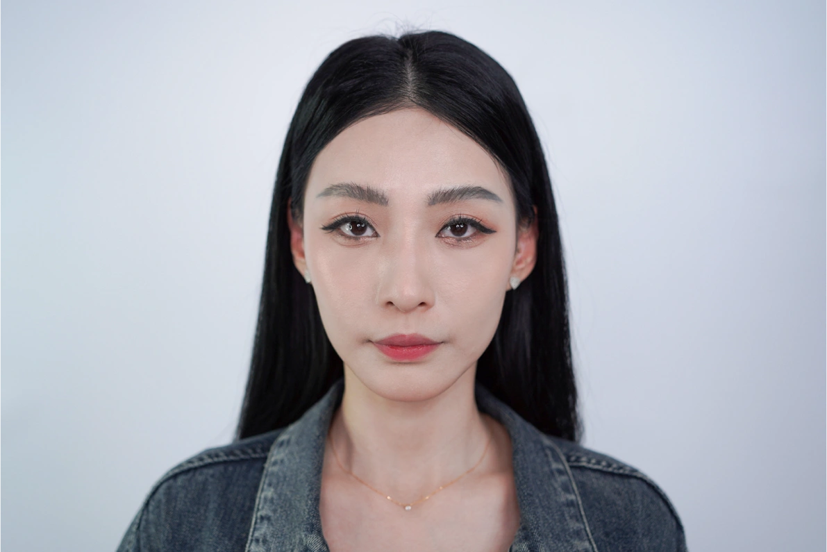 案例手術後照片