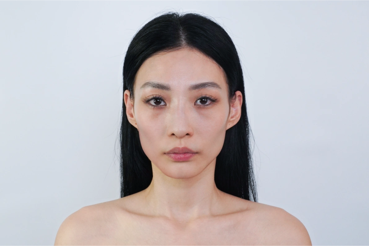 案例手術前照片