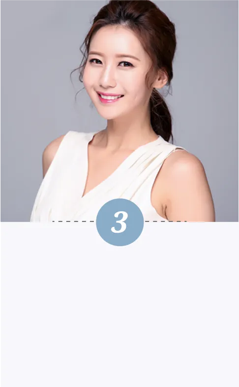 自體脂肪補臉-第三步驟