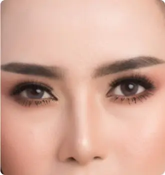 眼睛下垂眉壓眼