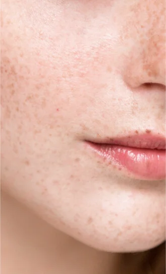 淡斑美白提亮膚色