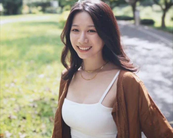 眼袋手術案例照片2-石靜