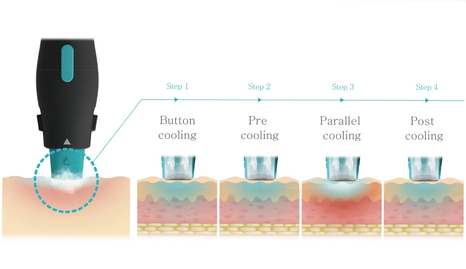 Cooling and vibration mechanism of OligioX