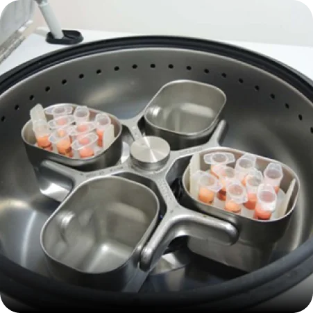 自體脂肪移植+PLT