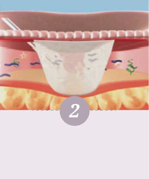 舒顏萃的作用模式-第二步驟