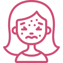 有毛孔粗大、凹洞痘疤問題者ICON