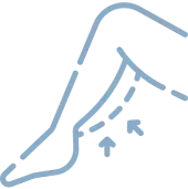 想針對部分部位做曲線精雕者-ICON