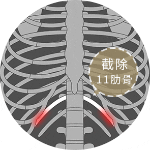 剝離肋骨上的骨膜，部份截除第11對肋骨。